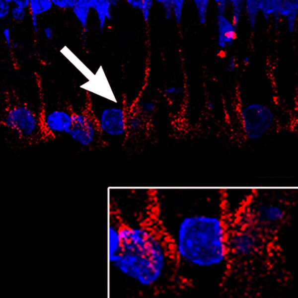 Confocal microscope image of a retinal section of a 48-month-old Octodon degus labeled with DSHB antibody 5A6 (red). PMID: 26267479, Fig. 5D.